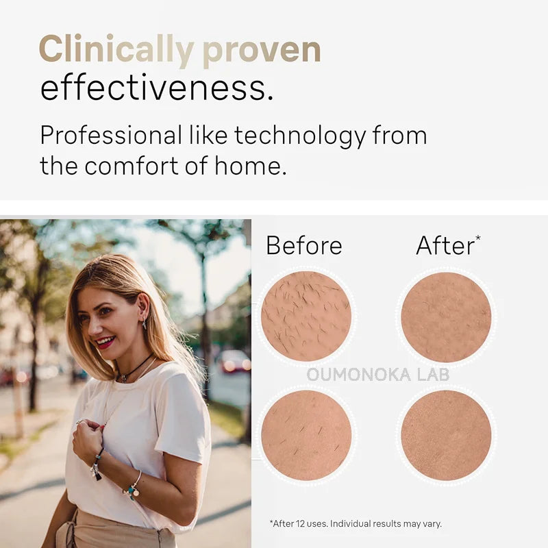 999999 Flashes IPL Laser Epilator for Women Home Use Devices Hair Removal Painless Electric Epilator Bikini Dropshipping